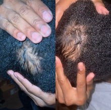 Load image into Gallery viewer, Hair Growth Oil
